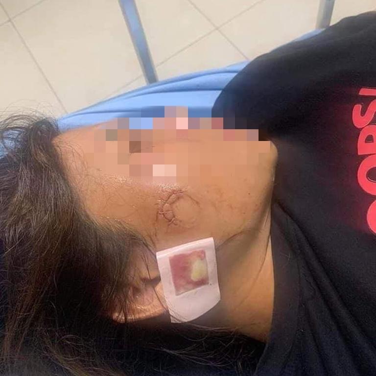 Xô xát do mâu thuẫn đi đường, một phụ nữ bị thương nghi súng bắn-1