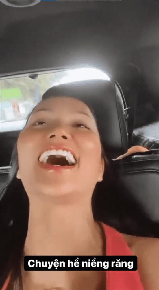 HHen Niê bị nghi sâu răng vì lý do không ngờ tới-1