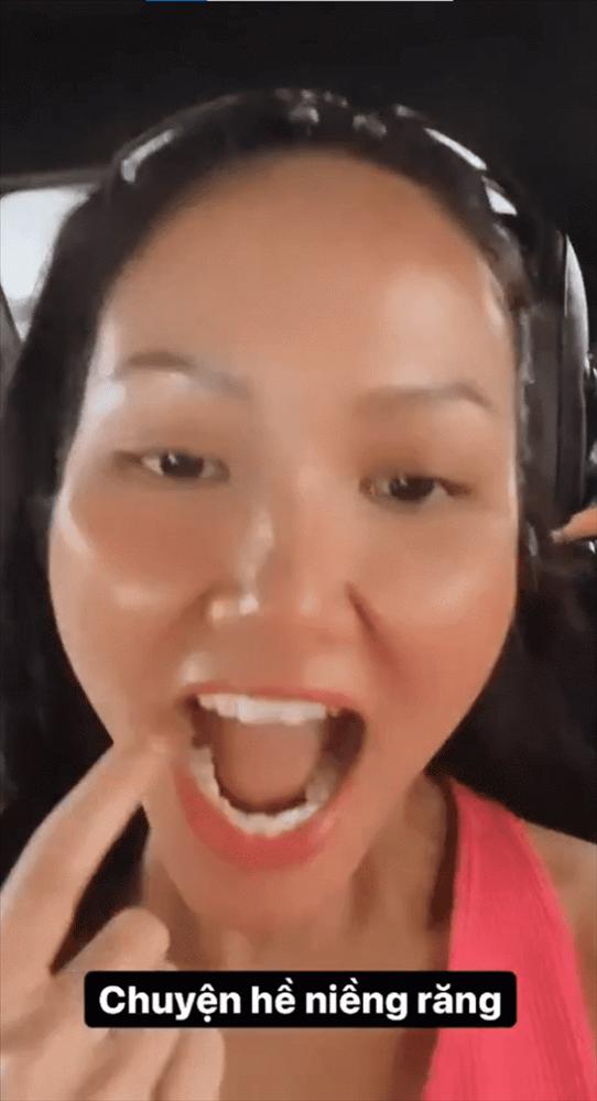 HHen Niê bị nghi sâu răng vì lý do không ngờ tới-2