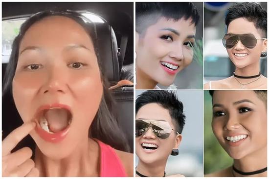H'Hen Niê bị nghi sâu răng vì lý do không ngờ tới