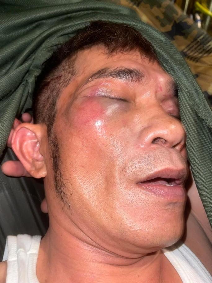 CLIP: Con trai danh ca Chế Linh bị đánh hội đồng dữ dội-2