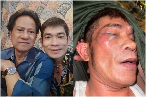 Chế Linh nói gì khi con bị đánh hội đồng thân tàn ma dại?-5