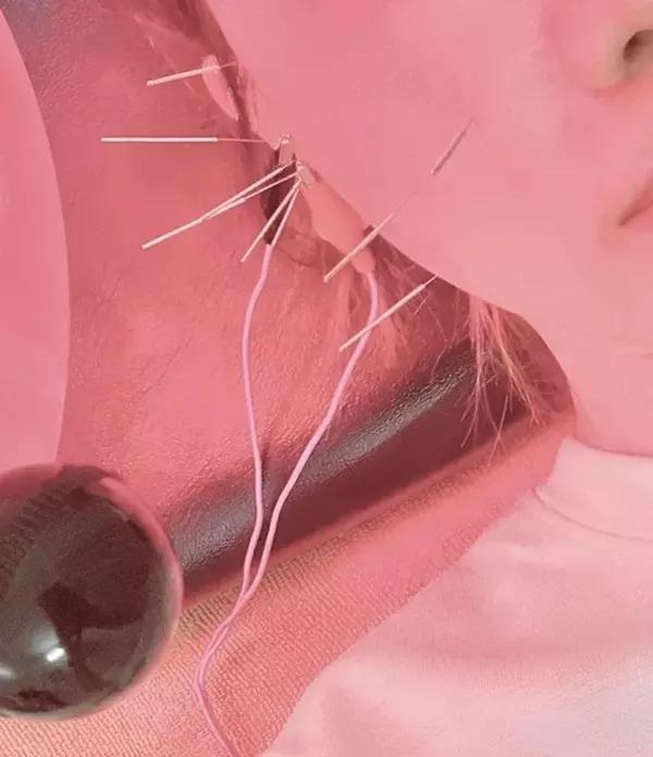 Hari Won biểu cảm 10 tấm như 1 vì liệt nửa mặt-10