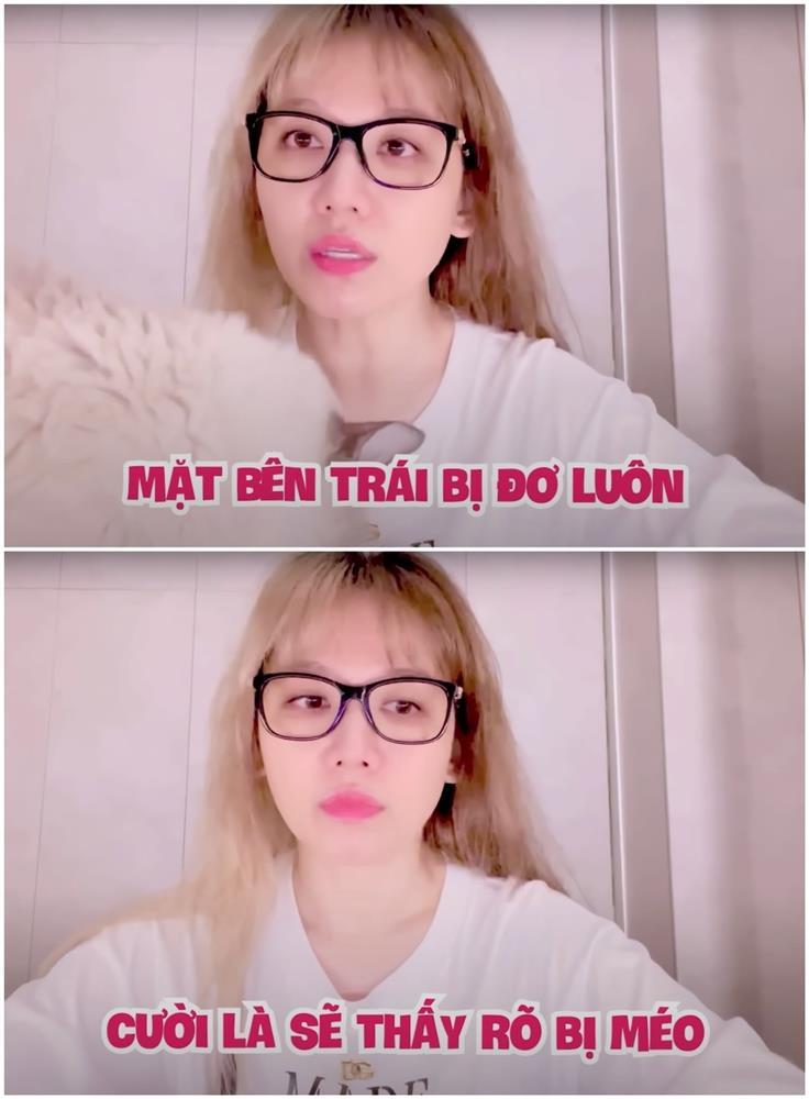 Hari Won zoom cận miệng cười méo xệch trước nghi án giả bệnh-1