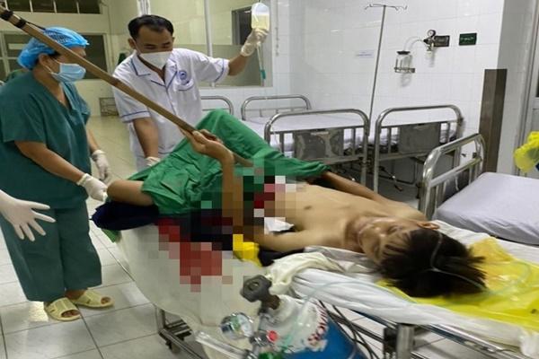Bé trai 12 tuổi bị dao cạo mủ cao su đâm xuyên bụng-4