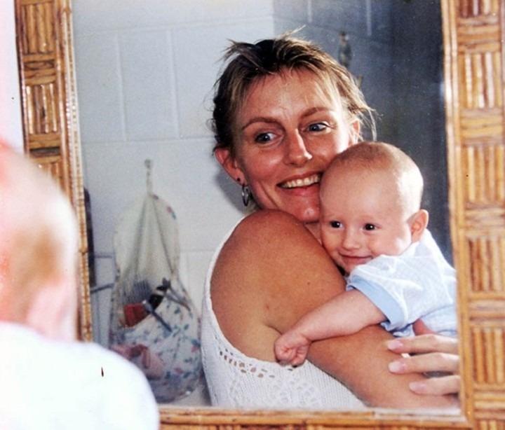 Hành trình tìm lại sự sống của cựu hoa hậu bị bỏng gần hết cơ thể-1