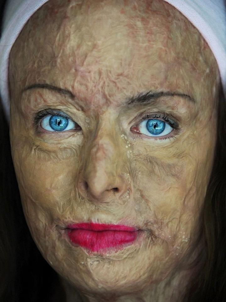 Hành trình tìm lại sự sống của cựu hoa hậu bị bỏng gần hết cơ thể-3