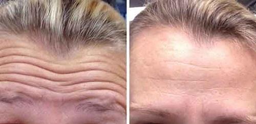 Nhìn tướng đoán mệnh: Đàn ông mặt phúc mỏng, khó lòng thăng tiến-3