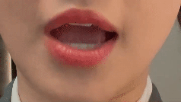 Trước Hari Won, Lou Hoàng và Justin Bieber cũng bị liệt nửa mặt-2