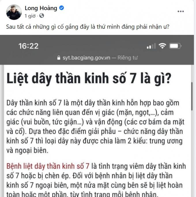 Trước Hari Won, Lou Hoàng và Justin Bieber cũng bị liệt nửa mặt-5