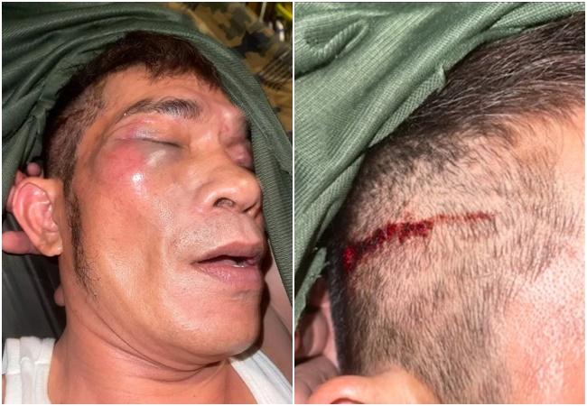 Chế Linh nói gì khi con bị đánh hội đồng thân tàn ma dại?-2