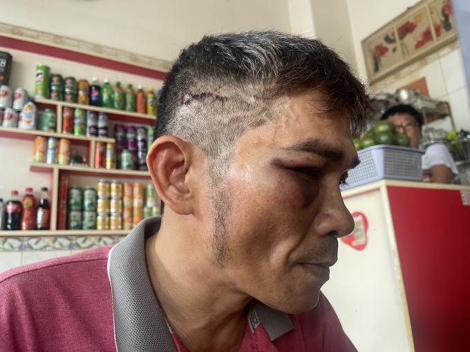 Chế Linh nói gì khi con bị đánh hội đồng thân tàn ma dại?-3