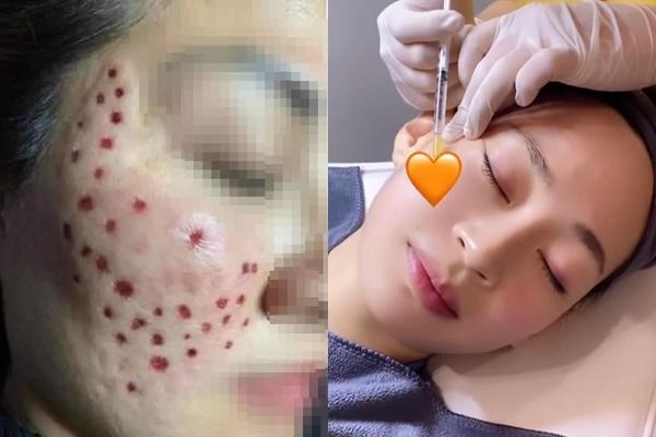 Cô gái chi bộn tiền thẩm mỹ hơn 60 lần, thành quả ai cũng sợ-6