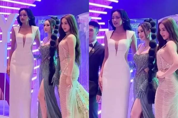 Nhiễm độc corticoid, da mỏng tang sau khi bôi kem trộn chữa nám-3