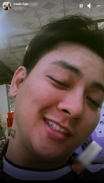 Hoài Lâm mắt thâm quầng, hình xăm trên mặt đã bị xóa?-5