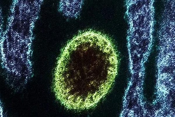 Trung Quốc phát hiện loại virus mới, chưa có thuốc chữa-1