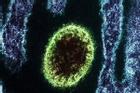 Trung Quốc phát hiện loại virus mới, chưa có thuốc chữa