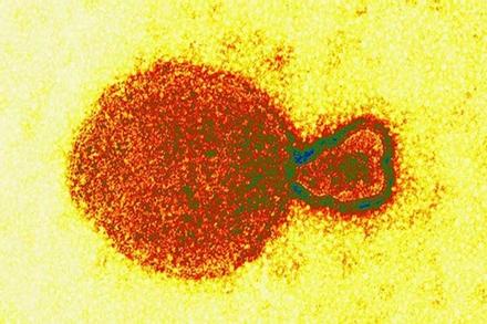 Sự nguy hiểm của loại virus mới được phát hiện ở Trung Quốc