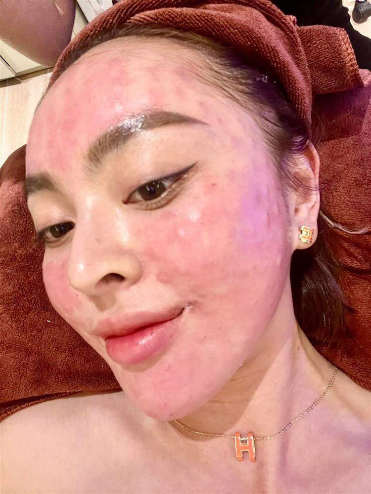 Livestream nói về scandal, Trang Nemo để lộ mặt đơ sưng phù-6