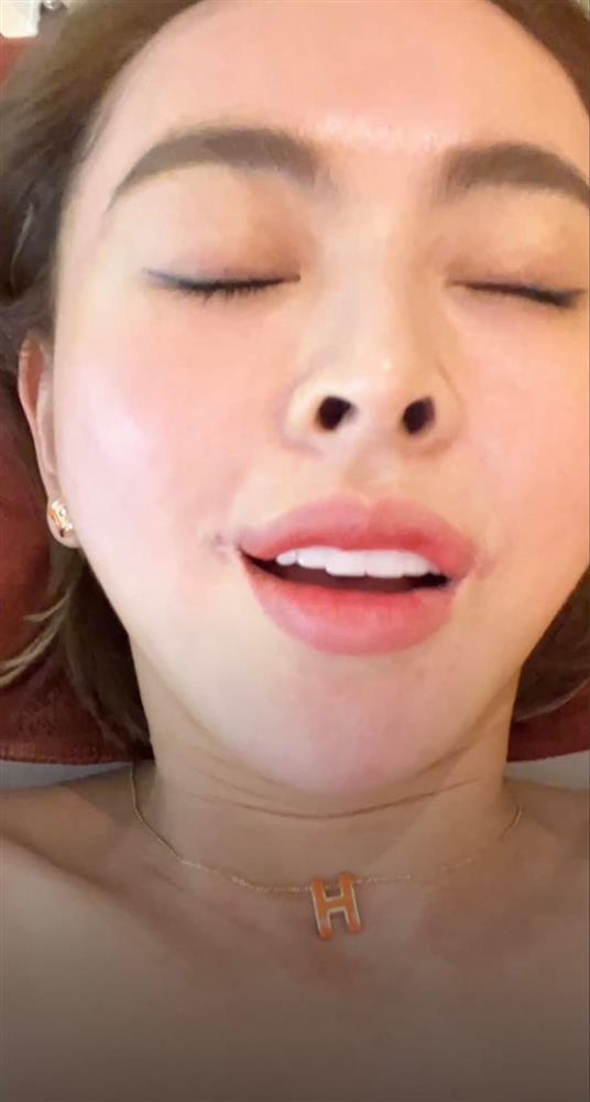 Livestream nói về scandal, Trang Nemo để lộ mặt đơ sưng phù-7