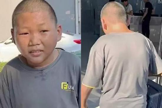 Chàng trai 27 tuổi không kiếm được việc vì nhìn như trẻ lên 10