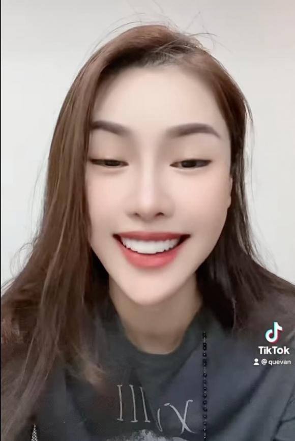 Quế Vân rụng răng sứ trông dở khóc dở cười-6