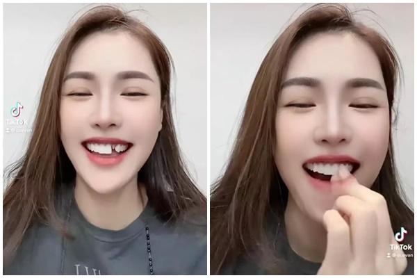 Tranh cãi diễn viên Thanh Hương vào vai nghèo nhưng răng sứ sáng lóa-5