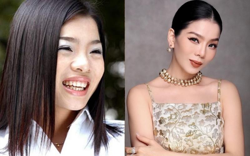 9 sao Việt thừa nhận sửa mũi-2