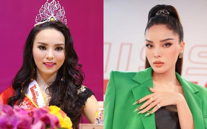 9 sao Việt thừa nhận sửa mũi-4