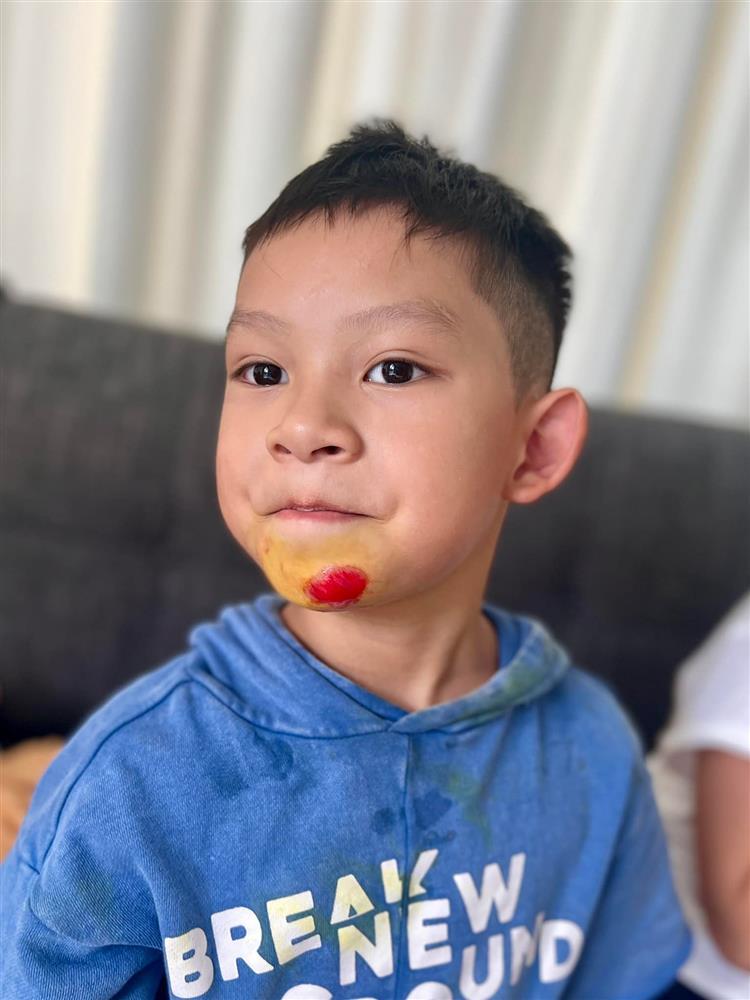 Tin showbiz Việt ngày 23/8: Con trai Lý Hải liên tục chấn thương-1