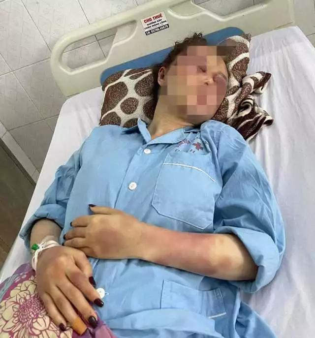 Người phụ nữ kể lại đêm kinh hoàng bị bạn trai đánh dập mũi gãy hàm-2