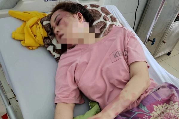 Diễn biến mới nhất sức khoẻ của nạn nhân bị cán bộ QLTT đánh đập-3