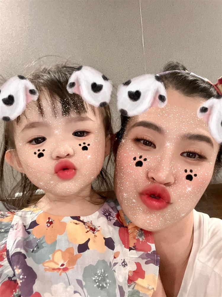 Tin showbiz Việt ngày 25/8: Trấn Thành mặt sưng như trái bóng-2