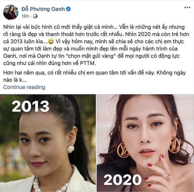 Nhan sắc Quỳnh Búp Bê Phương Oanh trước phẫu thuật thẩm mỹ-3