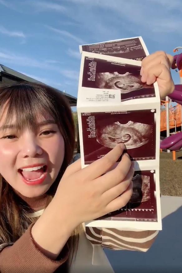 Múi Xù về Việt Nam sau 5 tháng một mình sang Mỹ cấy con-6