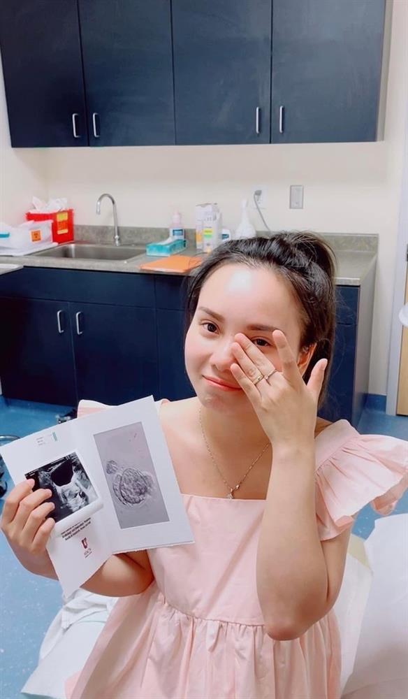 Múi Xù về Việt Nam sau 5 tháng một mình sang Mỹ cấy con-5