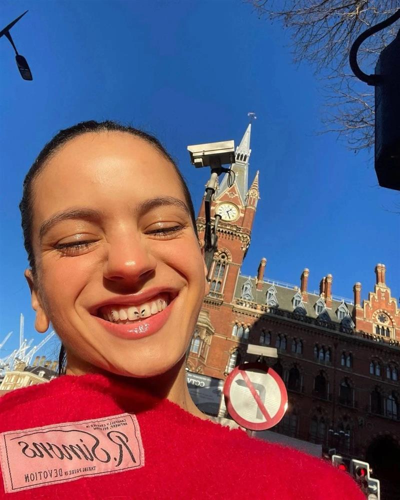 Bất chấp nguy hiểm chạy theo mốt gắn đá quý vào răng trên TikTok-3