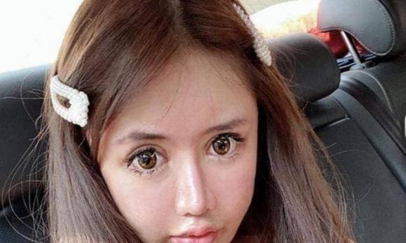 Cô gái chi bộn tiền thẩm mỹ hơn 60 lần, thành quả ai cũng sợ-5