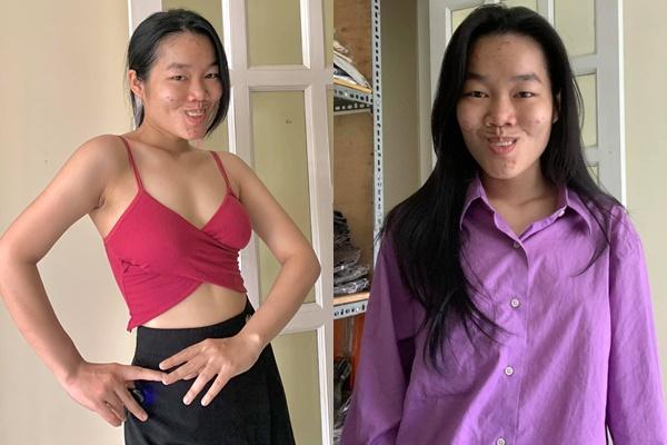 TikToker 3 triệu follower lột xác lạ lẫm sau cặp nách toàn lông-5