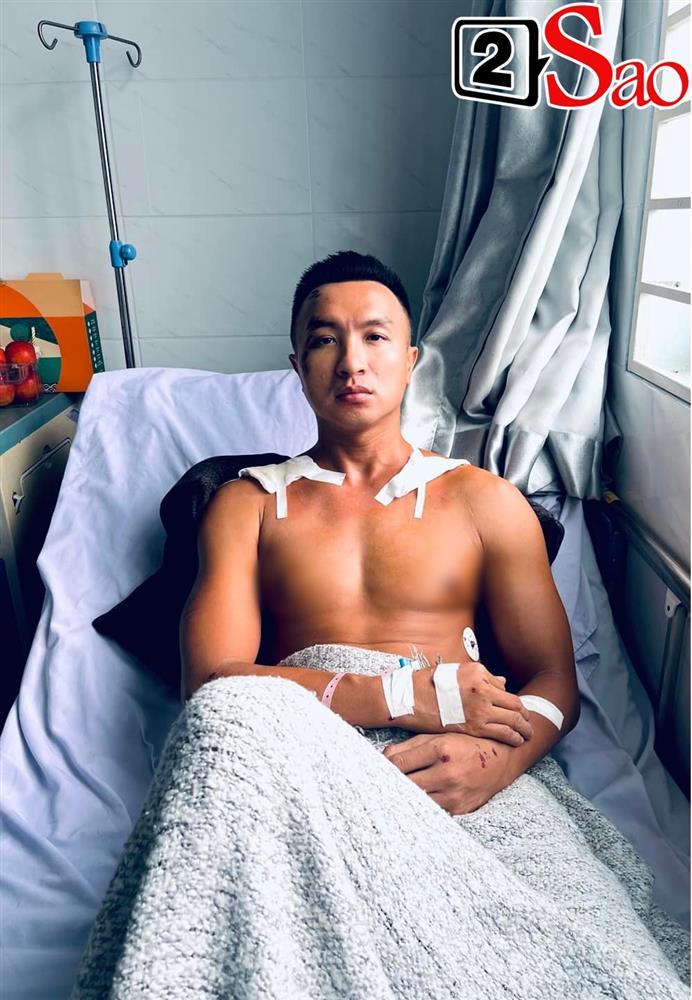 Nam MC đình đám bị tai nạn, lệch hàm, gãy đôi xương vai-1