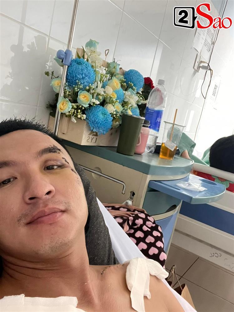 Nam MC đình đám bị tai nạn, lệch hàm, gãy đôi xương vai-2