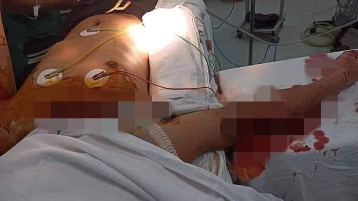 Nam sinh lớp 10 ở Hải Phòng bị bạn đâm tử vong trên đường đi học về-2