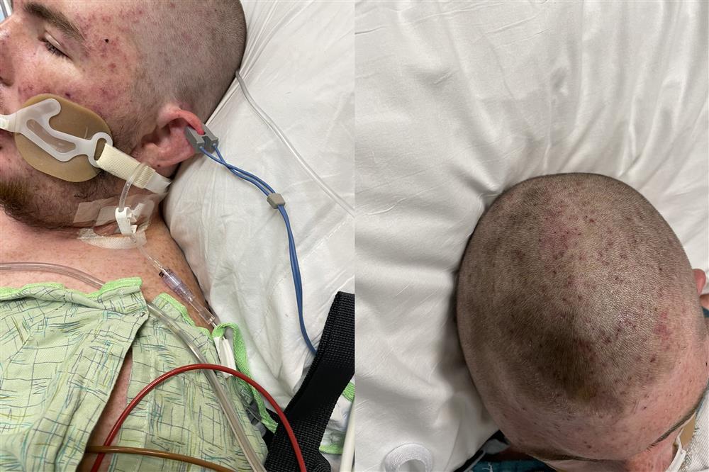 Người đàn ông suýt tử vong vì bị ong đốt hơn 20.000 vết-2