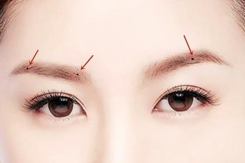 4 nốt ruồi phú quý song hành, ai sở hữu thì tiền bạc dồi dào-1