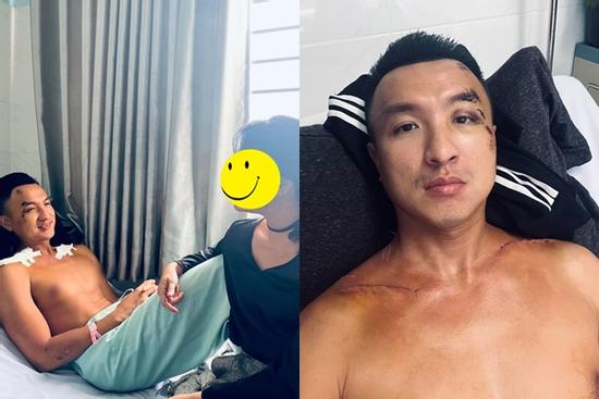 Tình hình nam MC sau tai nạn phải nối xương, lệch hàm