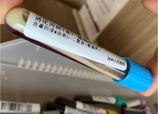 Máu biến thành màu trắng sữa do ăn lẩu quá nhiều-3