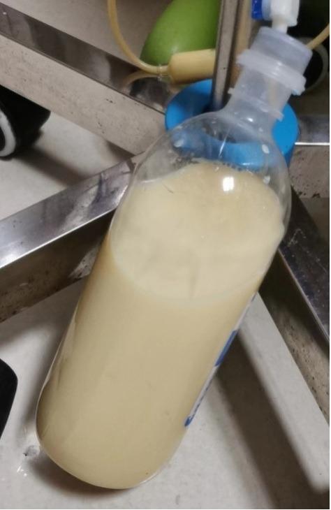 Máu biến thành màu trắng sữa do ăn lẩu quá nhiều-5