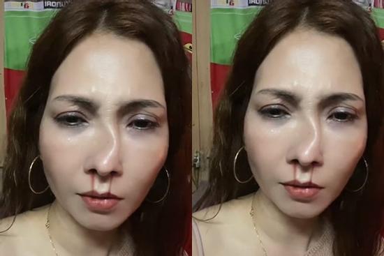 Sự thật cô gái làm đẹp bị chồng đánh méo mũi xôn xao cõi mạng