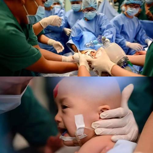 Ảnh mới nhất về cặp song Nhi sau 2 năm phẫu thuật tách dính-4