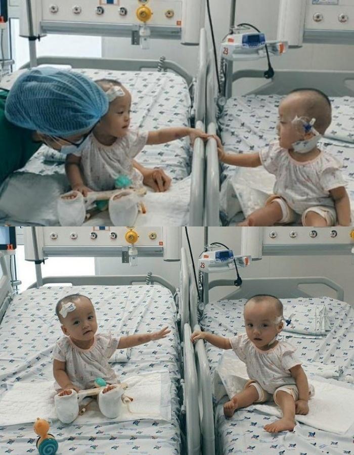 Ảnh mới nhất về cặp song Nhi sau 2 năm phẫu thuật tách dính-5